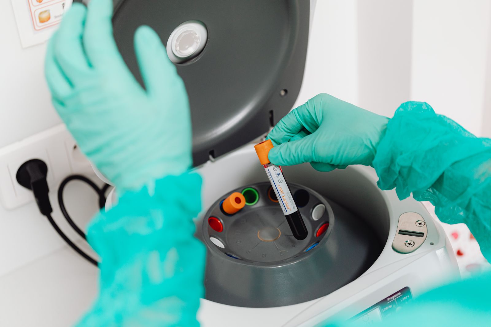 Haematology & Coagulation Screening