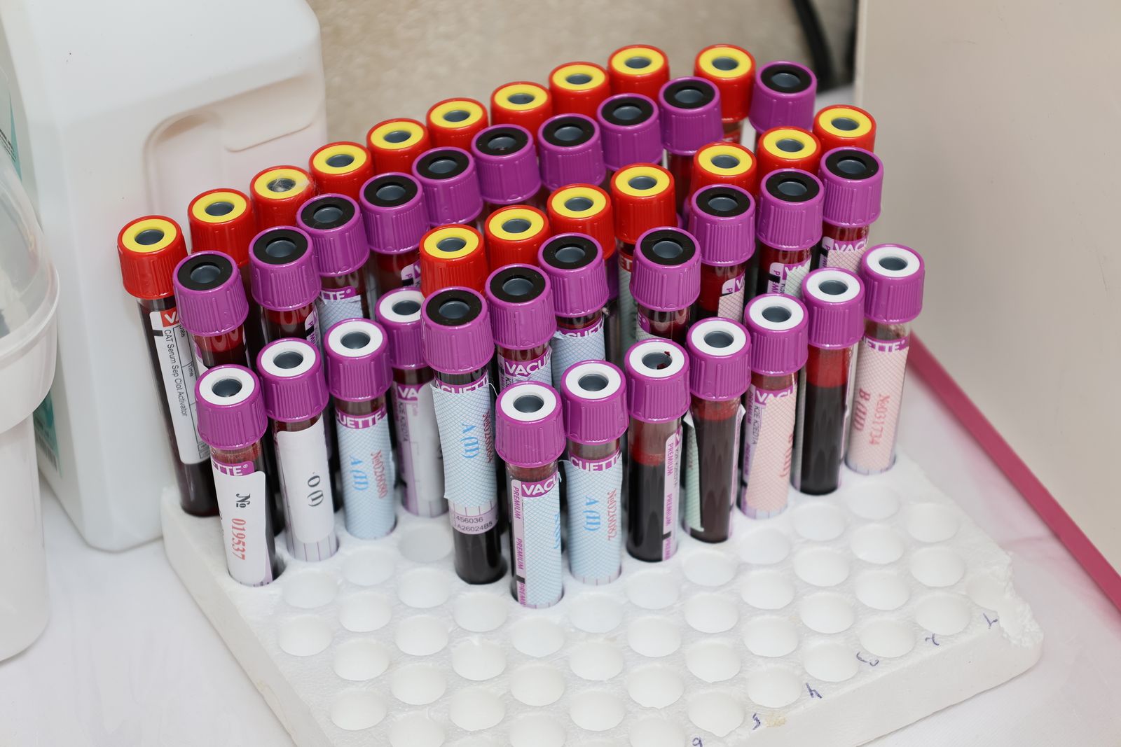 Serology & Infectious Disease Screening